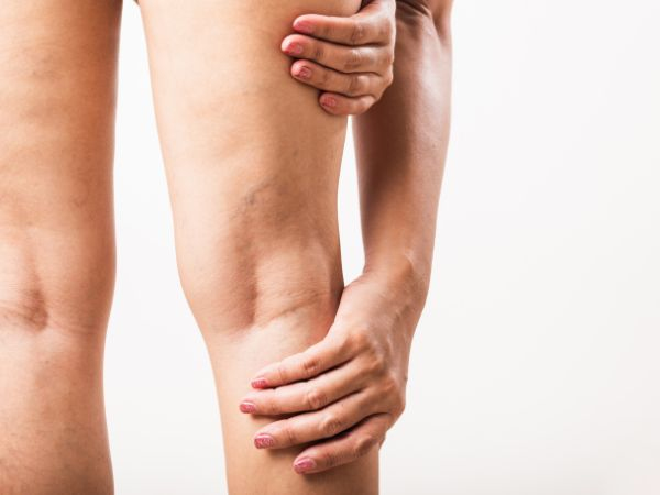 Pernas Leves e Lindas: Escleroterapia com até 12% de Desconto! 1 sessão por R$149,00 ou 3 por apenas R$399,00!