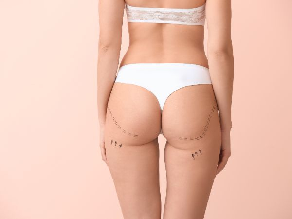 3 sessões  pump up por R$89,90 ou 3 sessões de punp up com endermoterapia + manta posterior coxa R$149,90